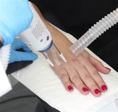 Laser de alta frequência